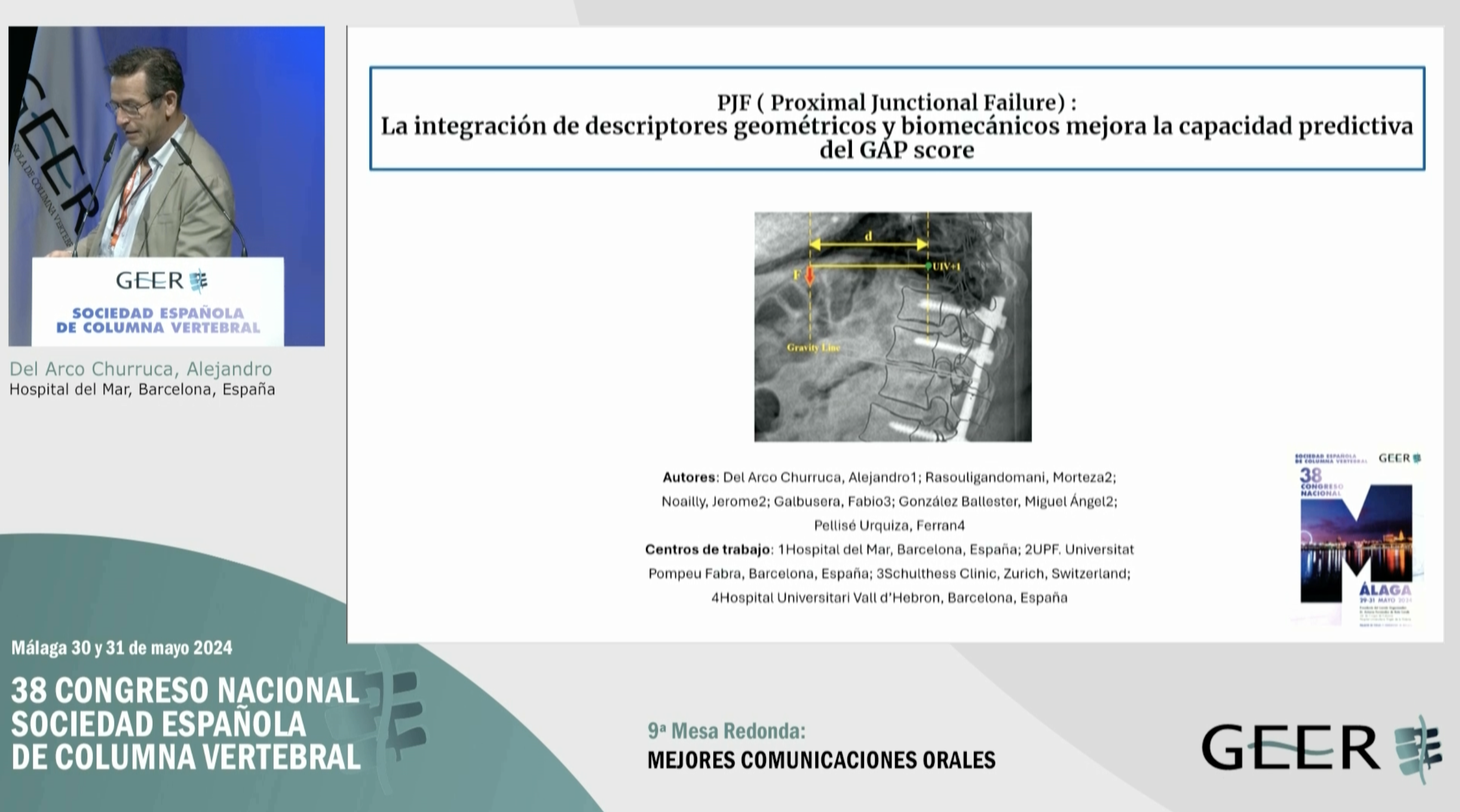 C.O.44. PJF (Proximal Junctional Failure): la integración de descriptores geométricos y biomecánicos mejora la capacidad predictiva del GAP score